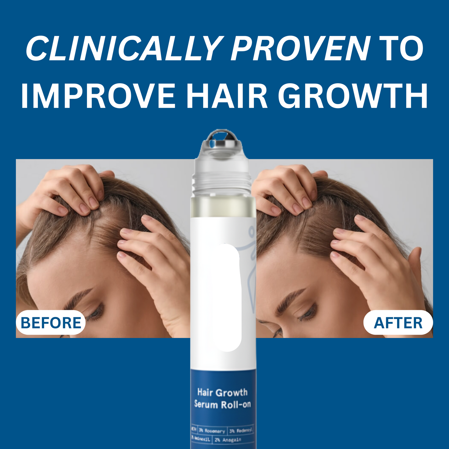 RollBack™ Roller (Pack of 2)